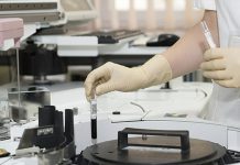 У Тимочкој Крајини се месо редовно контролише Лабораторија