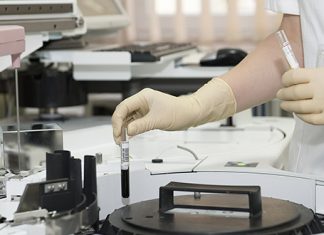 У Тимочкој Крајини се месо редовно контролише Лабораторија