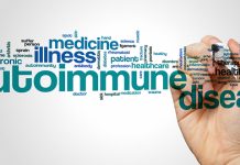 Скривени симптоми аутоимуних болести Аутоимуна болест