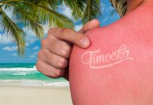 ОПАСАН ТРЕНД: Беле тетоваже су хит овог лета Бела тетоважа — Опекотина од сунца