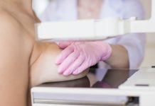 Зајечар: У септембру скрининг дојке за жене рођене 1962. године Мамограф — Преглед, скрининг дојке