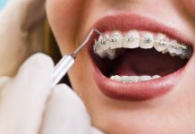 Цена савршеног осмеха: Због „фиксне“ протезе могу да страдају десни Зубар проверава жени њену зубну протезу