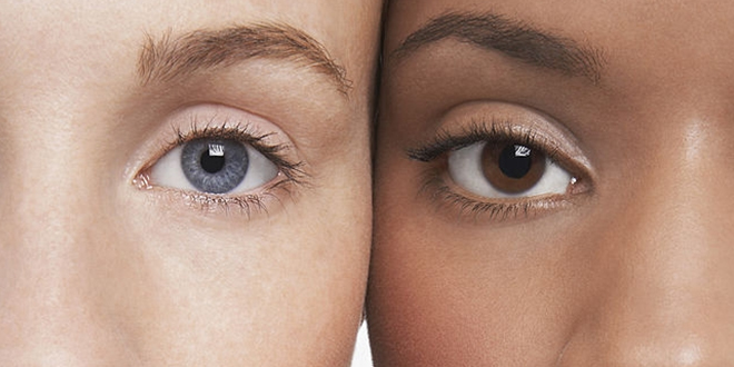 Две девојке са различитим бојама очију Две девојке са различитим бојама очију