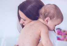 Побијена стара теорија: Заправо колико дуго мајчин имунитет штити бебу? Мајка се стара о својој беби са малим богињама