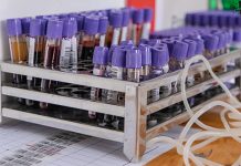 Акција добровољног давања крви 26. фебруара у Зајечару Вакуумске епрувете за прикупљање крви