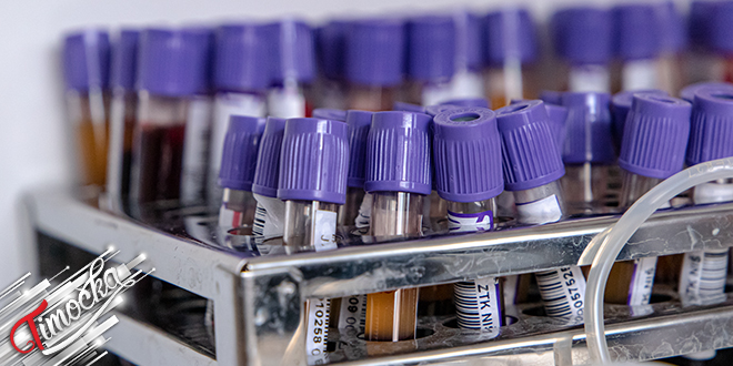 Вакуумске епрувете за прикупљање крви