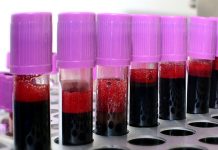 Добровољно давање крви у Зајечару 13. октобра Вакуумске епрувете за прикупљање крви