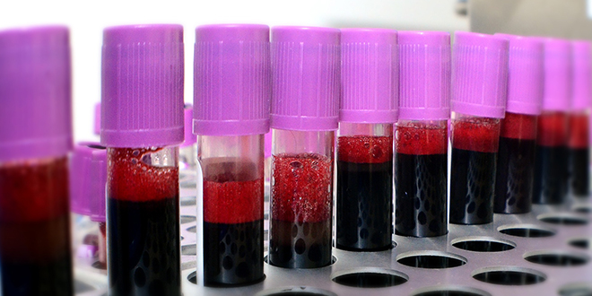 Вакуумске епрувете за прикупљање крви