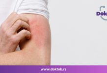 ДокТок: Како правилно лечити алергије